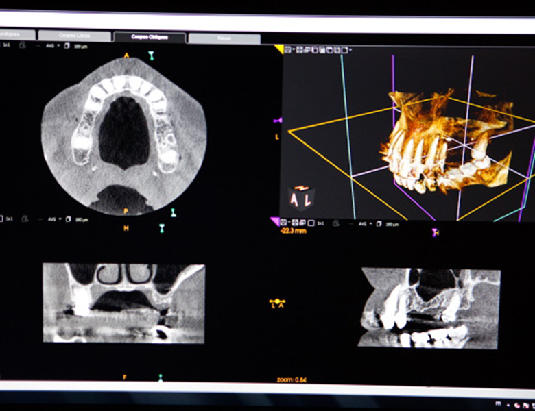 五反田の歯医者、ツツミ歯科クリニックの精密な診査診断