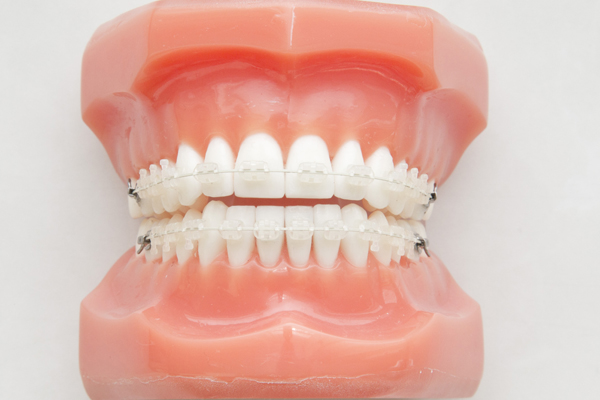 五反田の歯医者、ツツミ歯科クリニックの大人の矯正歯科