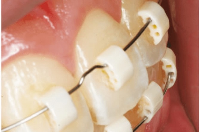 五反田の歯医者、ツツミ歯科クリニックの大人の矯正歯科