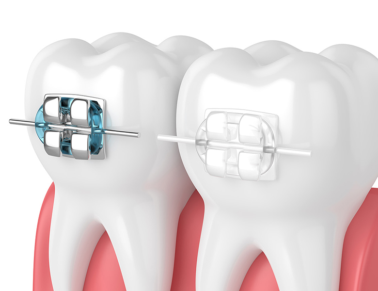 五反田の歯医者、ツツミ歯科クリニックの大人の矯正歯科