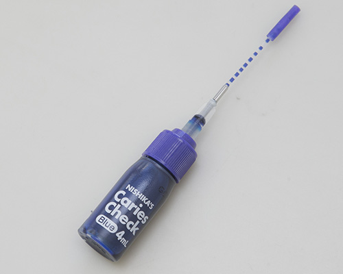 五反田の歯医者、ツツミ歯科クリニックのむし歯治療