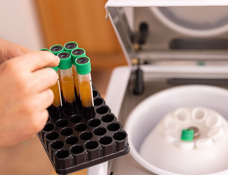 五反田の歯医者、ツツミ歯科クリニックの親しらずの抜歯