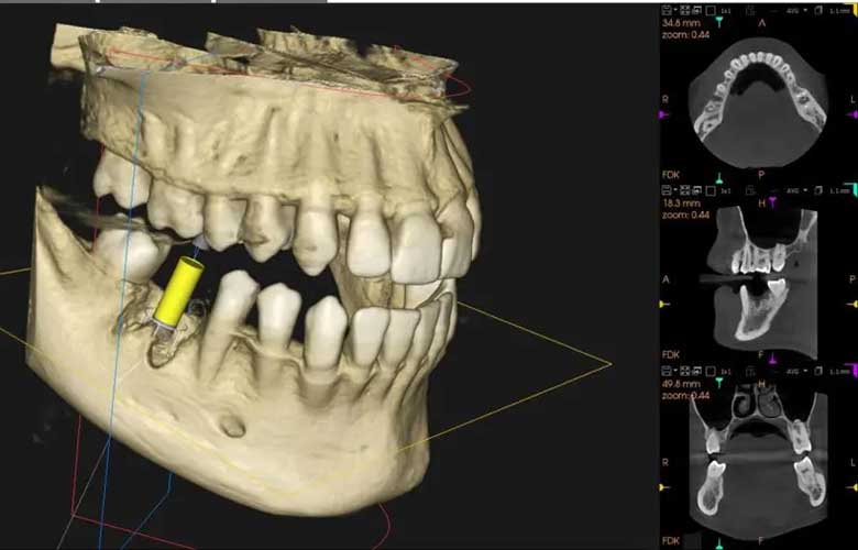 五反田の歯医者、ツツミ歯科クリニックの顎関節症治療