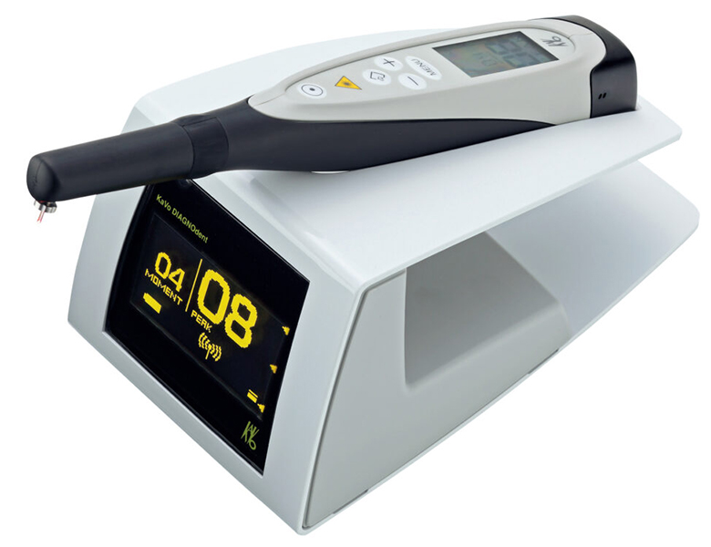 五反田の歯医者、ツツミ歯科クリニックのむし歯治療