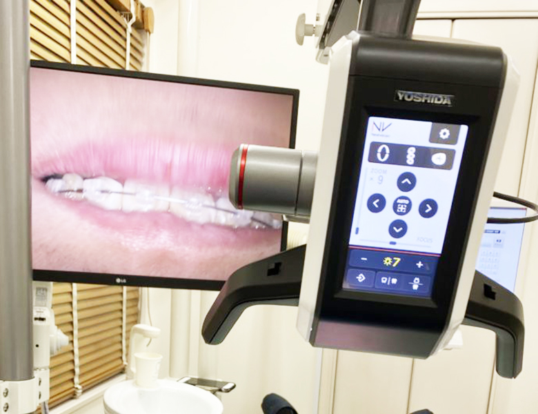 五反田の歯医者、ツツミ歯科クリニックのマイクロスコープ