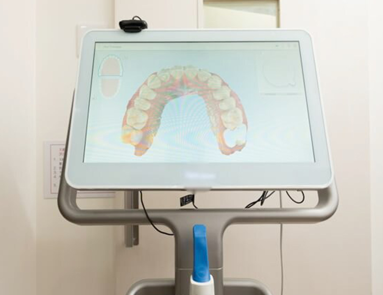 五反田の歯医者、ツツミ歯科クリニックの口腔内スキャナー