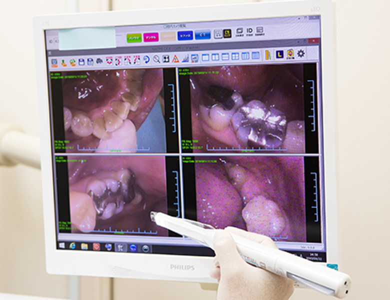 五反田の歯医者、ツツミ歯科クリニックの口腔内カメラ