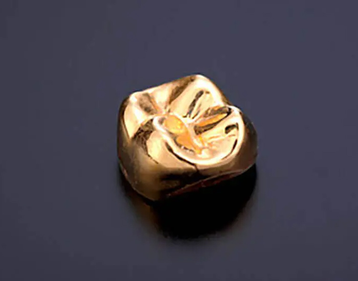 五反田の歯医者、ツツミ歯科クリニックの審美修復