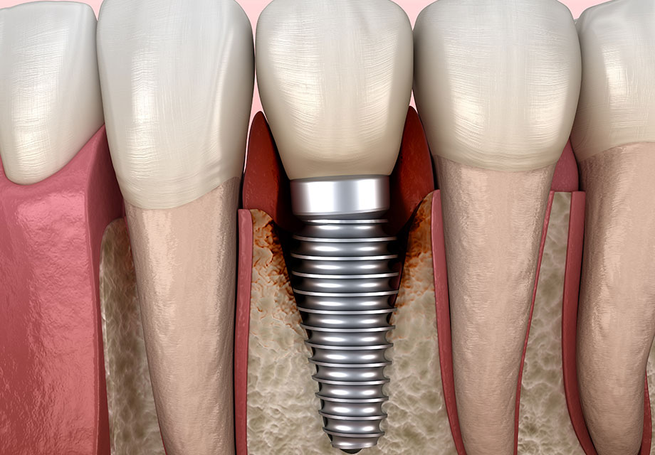 五反田の歯医者、ツツミ歯科クリニックの予防歯科