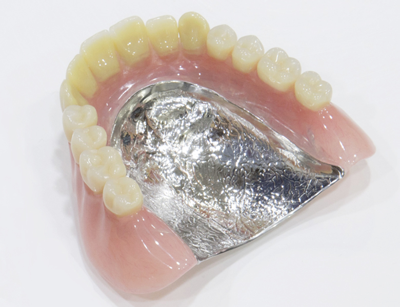 五反田の歯医者、ツツミ歯科クリニックの入れ歯治療