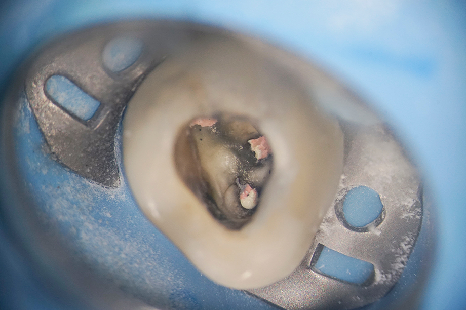 五反田の歯医者、ツツミ歯科クリニックの精密な診査診断