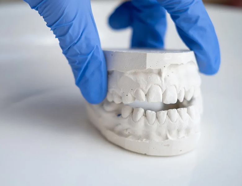 五反田の歯医者、ツツミ歯科クリニックのむし歯治療