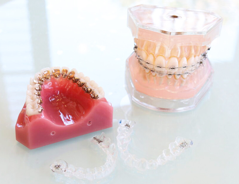 五反田の歯医者、ツツミ歯科クリニックの矯正歯科治療