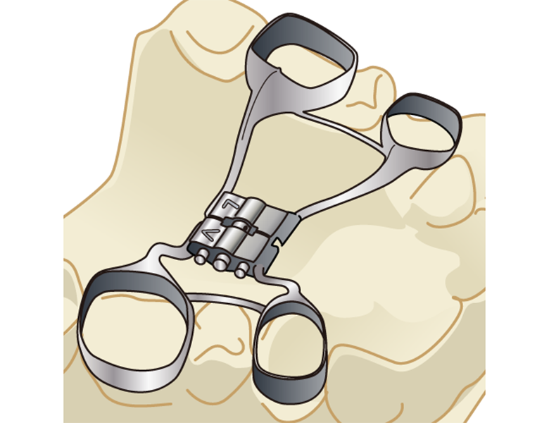 五反田の歯医者、ツツミ歯科クリニックの大人の矯正歯科