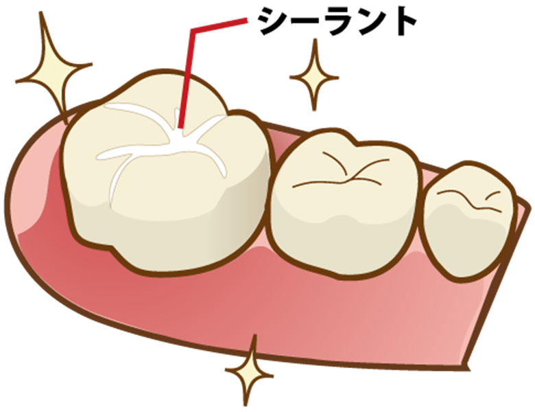 五反田の歯医者、ツツミ歯科クリニックの小児歯科