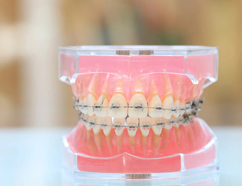 五反田の歯医者、ツツミ歯科クリニックの大人の矯正歯科