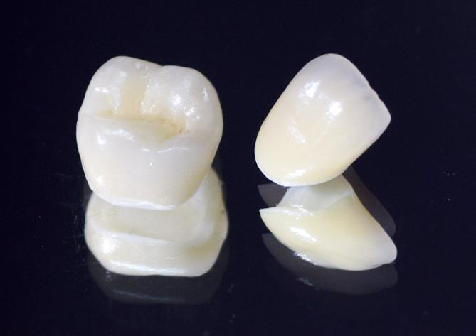 五反田の歯医者、ツツミ歯科クリニックの審美修復